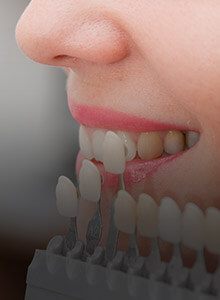 Teeth compared with coloring chart