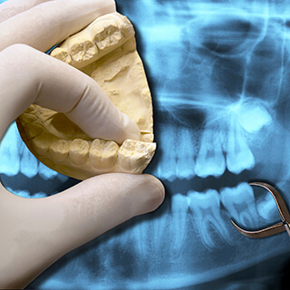 Dental model and x-ray comparison