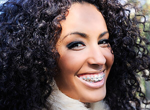 Smiling woman with tooth-colored braces